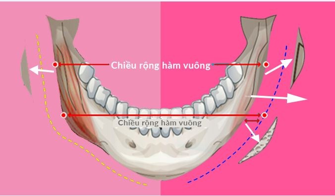 Benh vien tham my JW Han Quoc chi nhanh Viet Nam anh 3