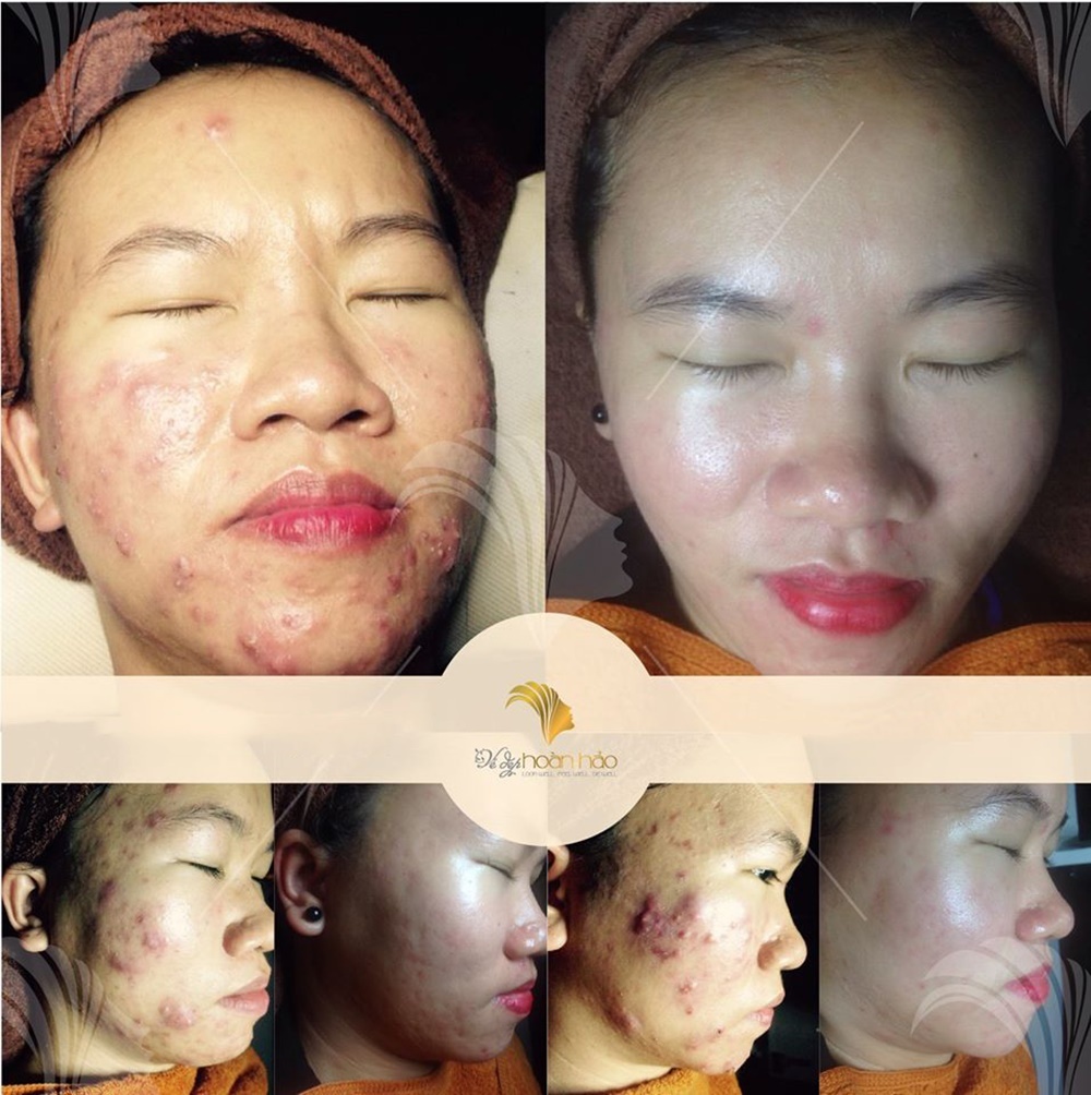 Vẻ đẹp Hoàn Hảo Clinic ảnh 9 Ve dep Hoan Hao Clinic anh 9