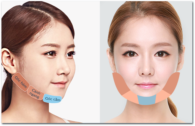 JW ra mat cong nghe got mat V-line toan dien hinh anh