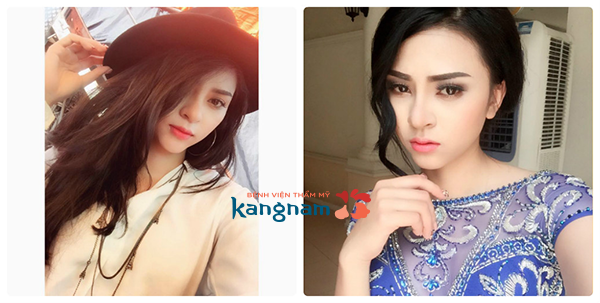 Bệnh viện thẩm mỹ Kangnam ảnh 4 Benh vien tham my Kangnam anh 4