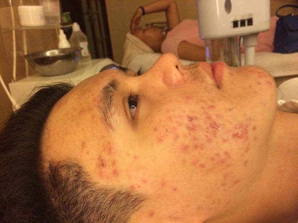 Thẩm mỹ viện Âu Việt ảnh 2 Tham my vien Au Viet anh 2