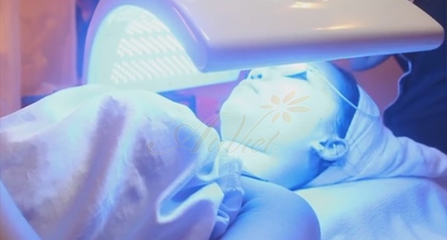 Thẩm mỹ viện Âu Việt ảnh 3 Tham my vien Au Viet anh 3