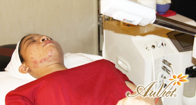 Thẩm mỹ viện Âu Việt ảnh 4 Tham my vien Au Viet anh 4