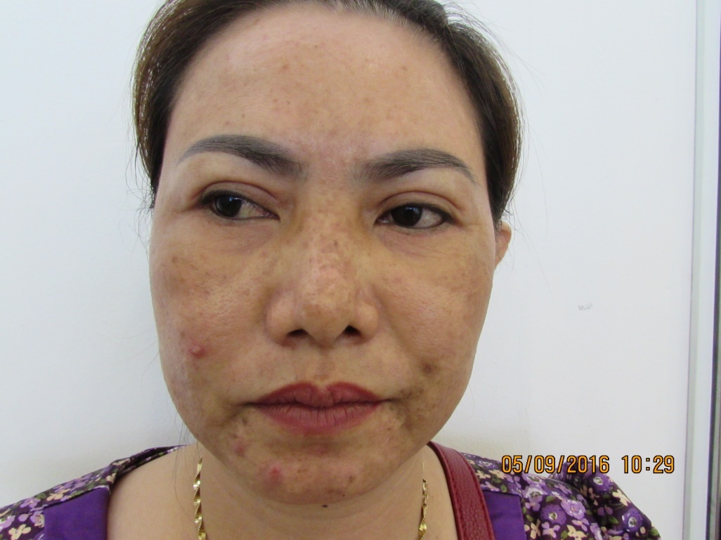 Benh vien JW Han Quoc,  Trung tam Skincare anh 2