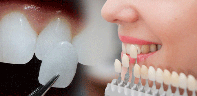 Benh Vien tham my JW Han Quoc,  Cong nghe dan su ve anh 2