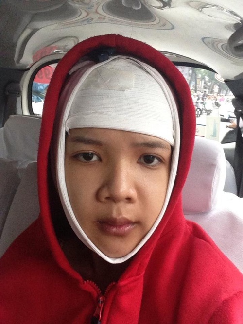 Bệnh viện thẩm mỹ JW Hàn Quốc, phẫu thuật thẩm mỹ ảnh 2 Benh vien tham my JW Han Quoc, phau thuat tham my anh 2