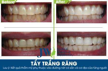 bệnh viện JW ảnh 4 benh vien JW anh 4