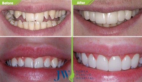 Benh vien tham my JW Han Quoc,  rang su anh 2