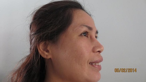 Bệnh viện Thẩm mỹ JW Hàn Quốc ảnh 4 Benh vien Tham my JW Han Quoc anh 4