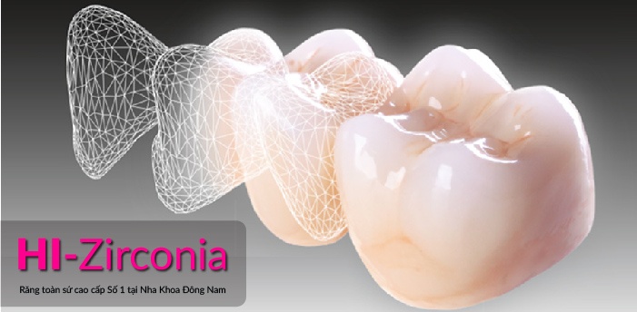 Nha khoa Dong Nam,  rang su Hi-Zirconia anh 2