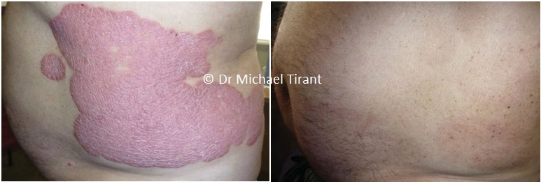 Dr Michaels ảnh 1 Dr Michaels anh 1