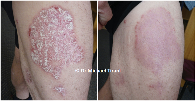 Dr Michaels ảnh 2 Dr Michaels anh 2