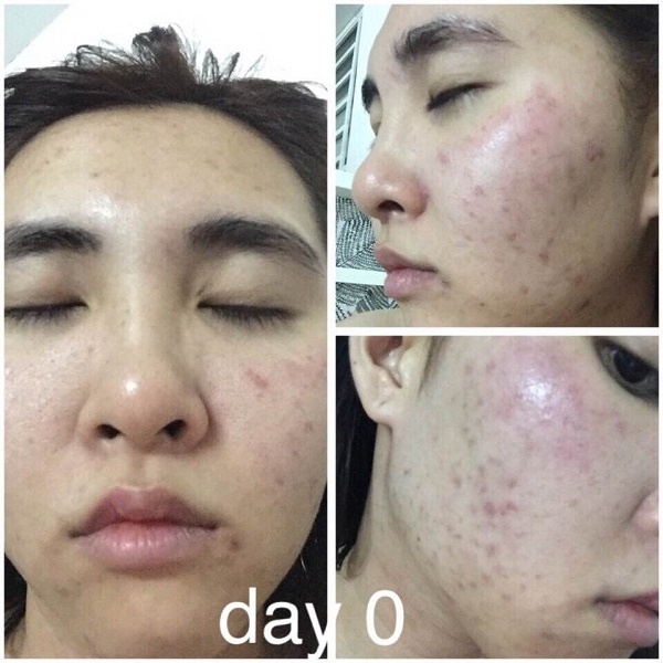 Bệnh viện thẩm mỹ JW ảnh 1 Benh vien tham my JW anh 1