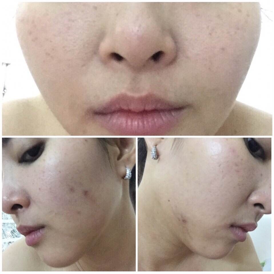 Bệnh viện thẩm mỹ JW ảnh 3 Benh vien tham my JW anh 3