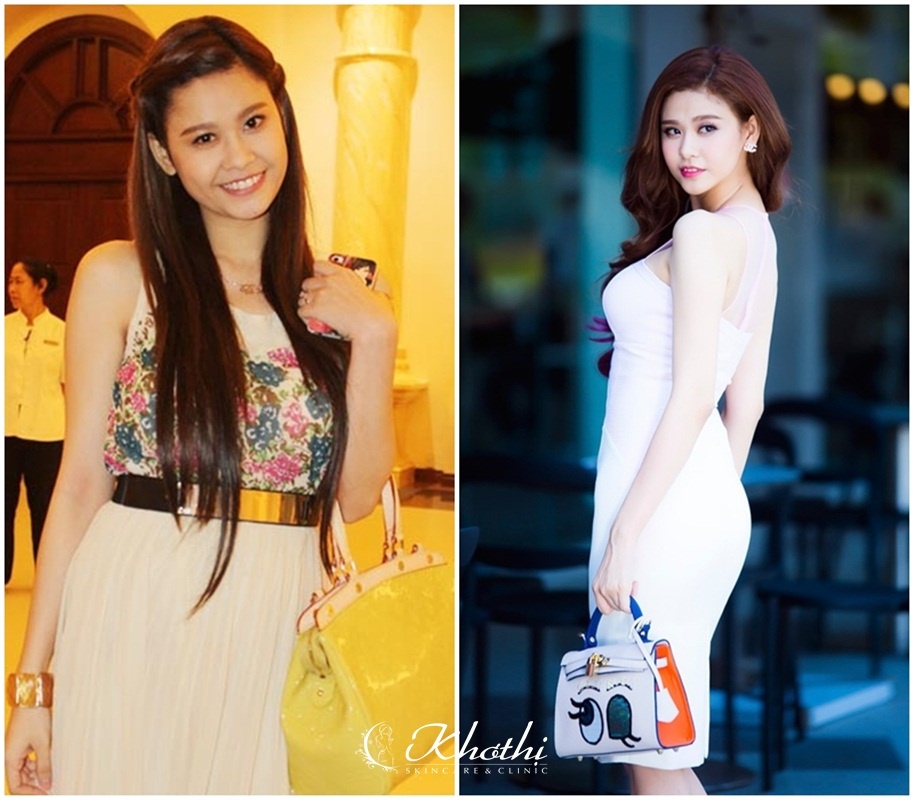 Viện thẩm mỹ Khơ Thị  ảnh 5 Vien tham my Kho Thi anh 5