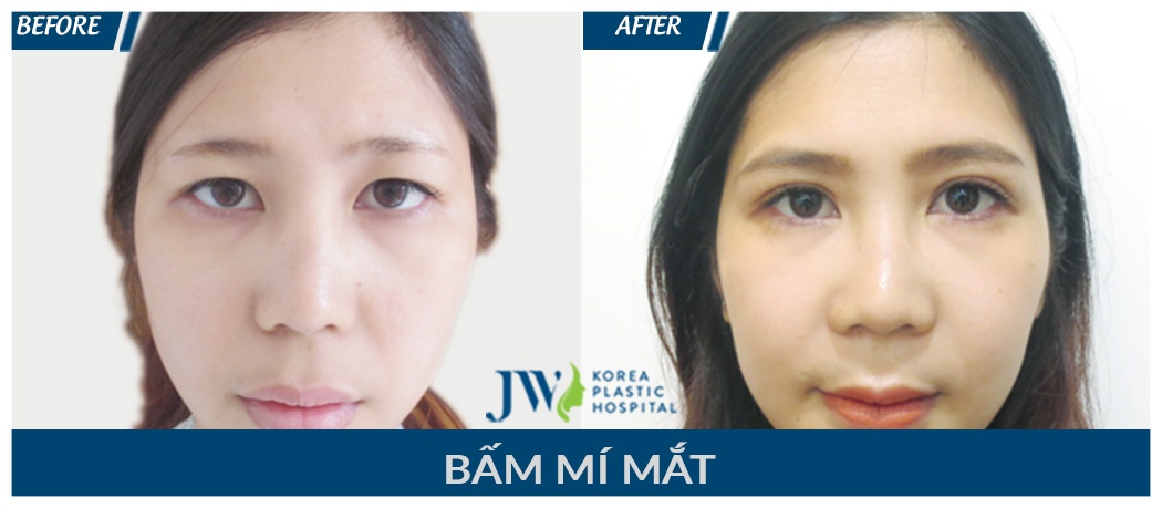 Bệnh viện thẩm mỹ JW ảnh 3 Benh vien tham my JW anh 3