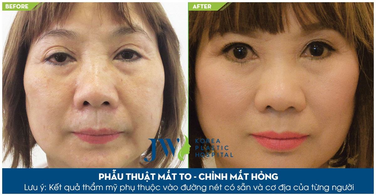 Bệnh viện thẩm mỹ JW ảnh 4 Benh vien tham my JW anh 4