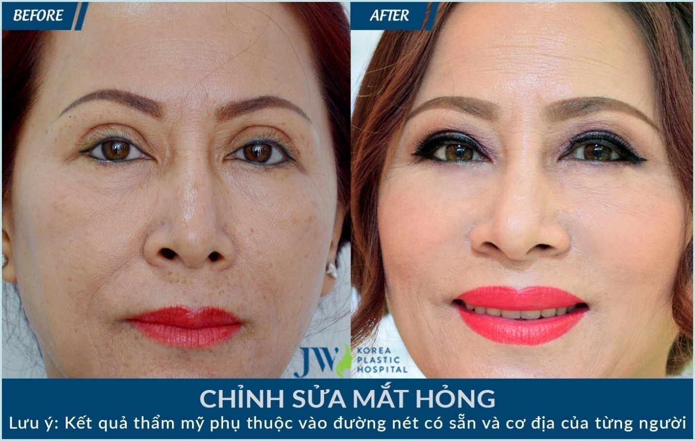 Bệnh viện thẩm mỹ JW ảnh 5 Benh vien tham my JW anh 5