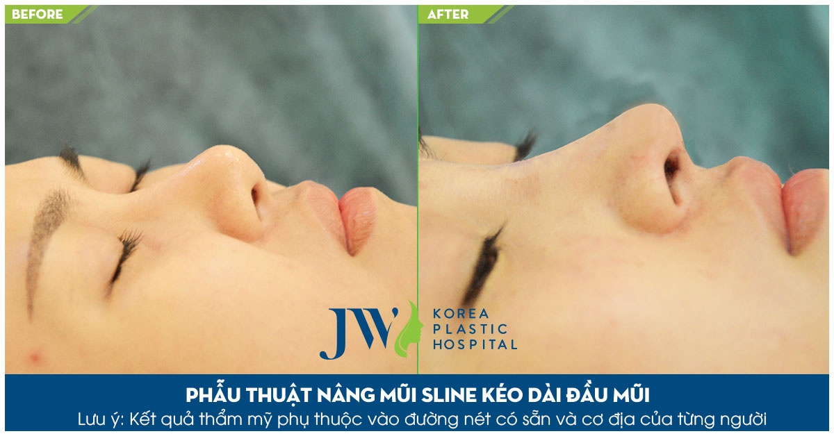 Benh vien Tham my Han Quoc anh 4