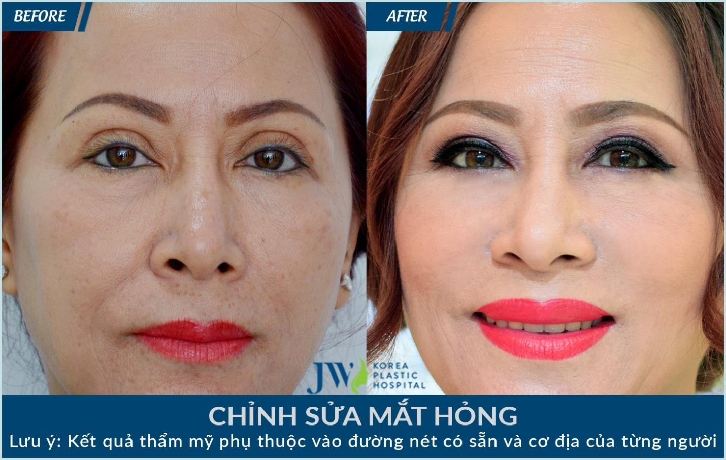 Benh vien Tham my Han Quoc anh 5