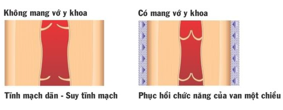 vo y khoa,  tat y khoa,  RelaxSan anh 1