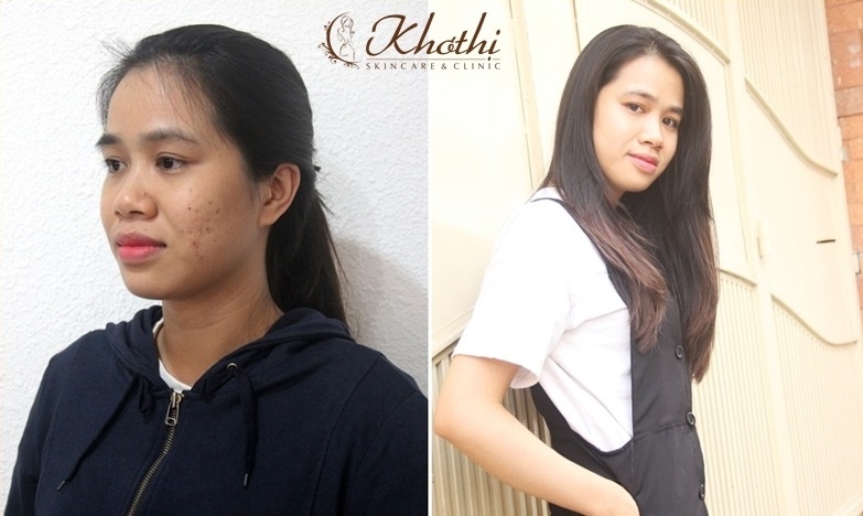 Viện Thẩm mỹ Khơ Thị ảnh 5 Vien Tham my Kho Thi anh 5