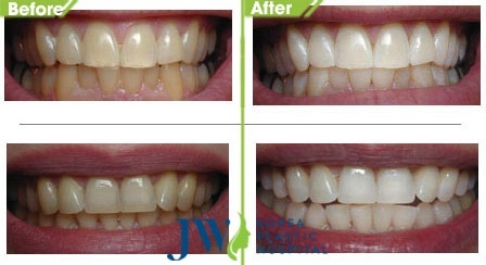 Bệnh viện thẩm mỹ JW ảnh 3 Benh vien tham my JW anh 3