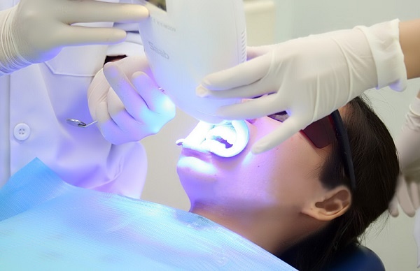 Cong nghe Laser Whitening cho ham rang trang sau 30 phut hinh anh