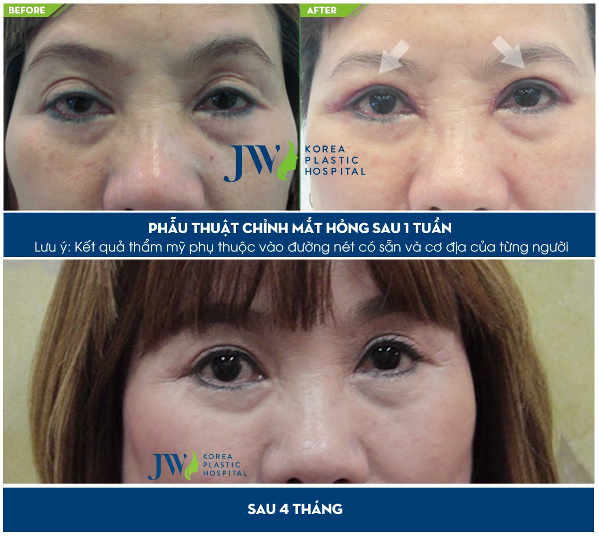 Benh vien tham my JW Han Quoc anh 2