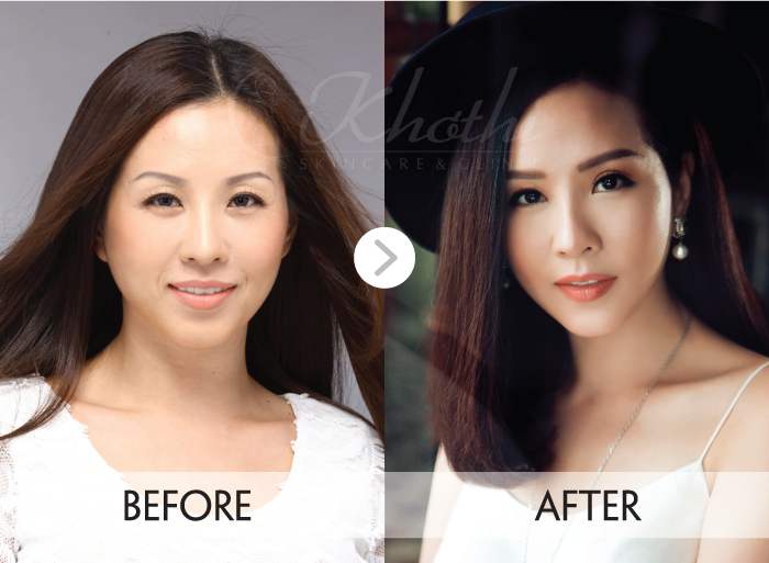 Khơ Thị ảnh 3 Kho Thi anh 3
