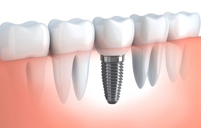 Bệnh viện thẩm mỹ JW Hàn Quốc ảnh 1 Benh vien tham my JW Han Quoc anh 1