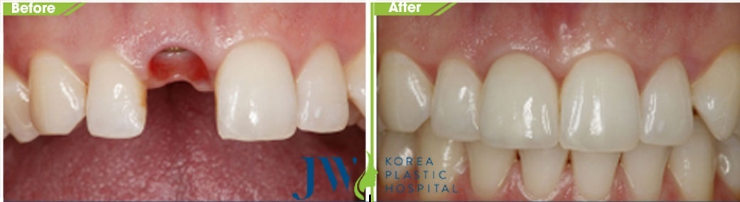 Bệnh viện thẩm mỹ JW Hàn Quốc ảnh 2 Benh vien tham my JW Han Quoc anh 2