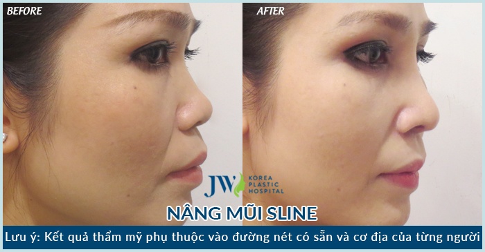 Bệnh viện thẩm mỹ JW Hàn Quốc chi nhánh Việt Nam ảnh 3 Benh vien tham my JW Han Quoc chi nhanh Viet Nam anh 3