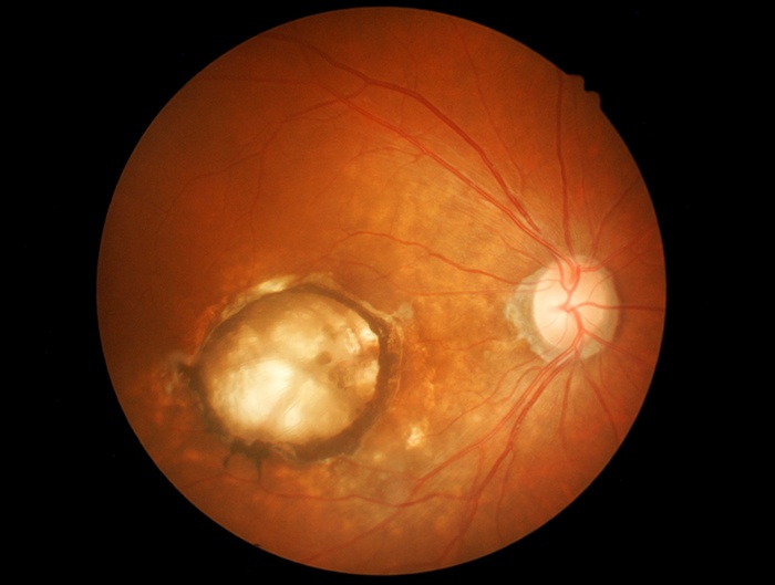 Ataxavi Vision  ảnh 2 Ataxavi Vision anh 2