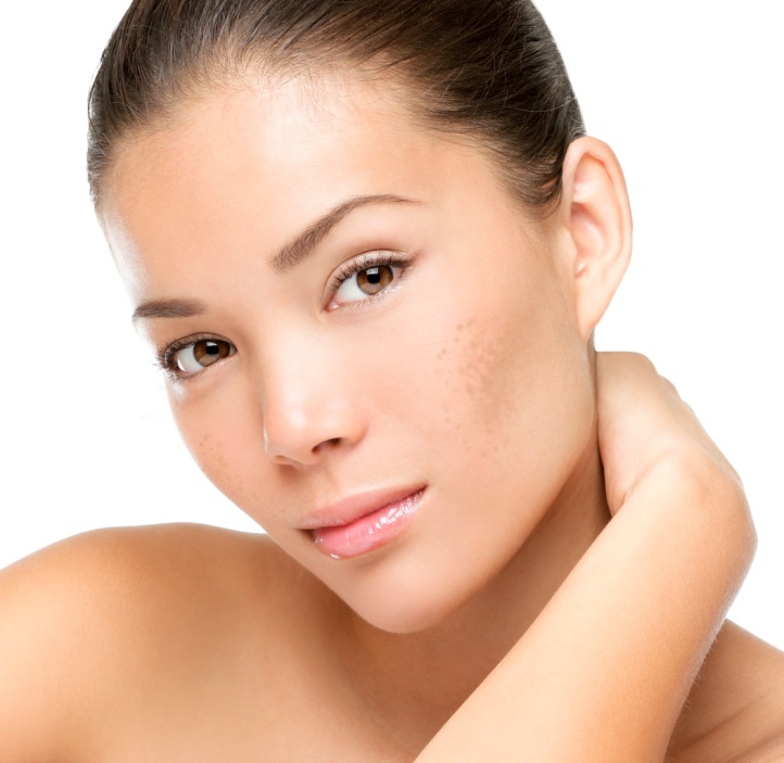 Acnes C10,  trị nám ảnh 1 Acnes C10,  tri nam anh 1
