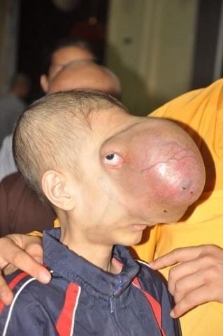 8 nam cua cau be khong co mat anh 1