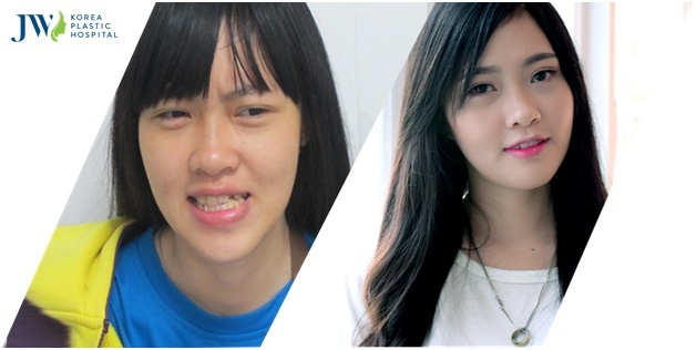 JW khuyen mai ‘5 ngay vang’ lam dep cho khach hang hinh anh