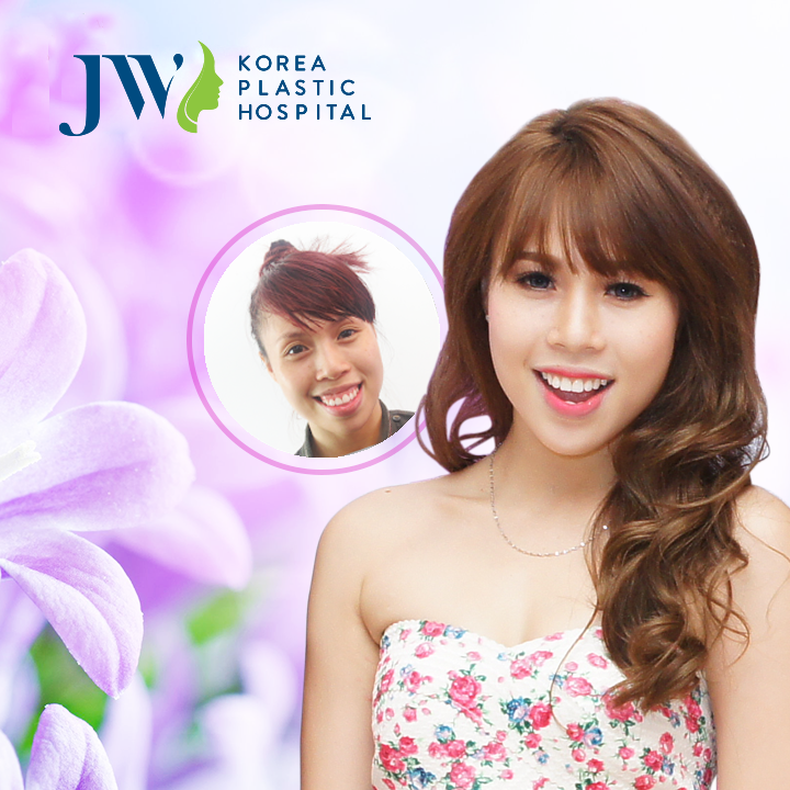 Bệnh viện thẩm mỹ JW ảnh 4 Benh vien tham my JW anh 4