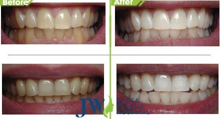 Bệnh viện thẩm mỹ JW Hàn Quốc  ảnh 1 Benh vien tham my JW Han Quoc anh 1