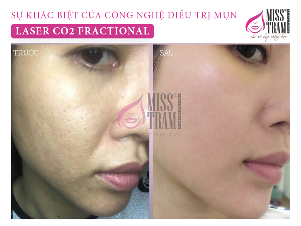 Miss Trâm spa ảnh 2 Miss Tram spa anh 2