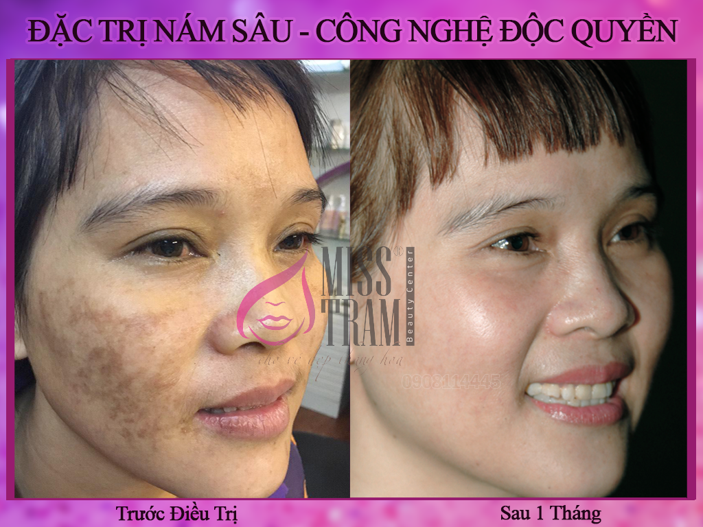 Miss Trâm spa ảnh 3 Miss Tram spa anh 3