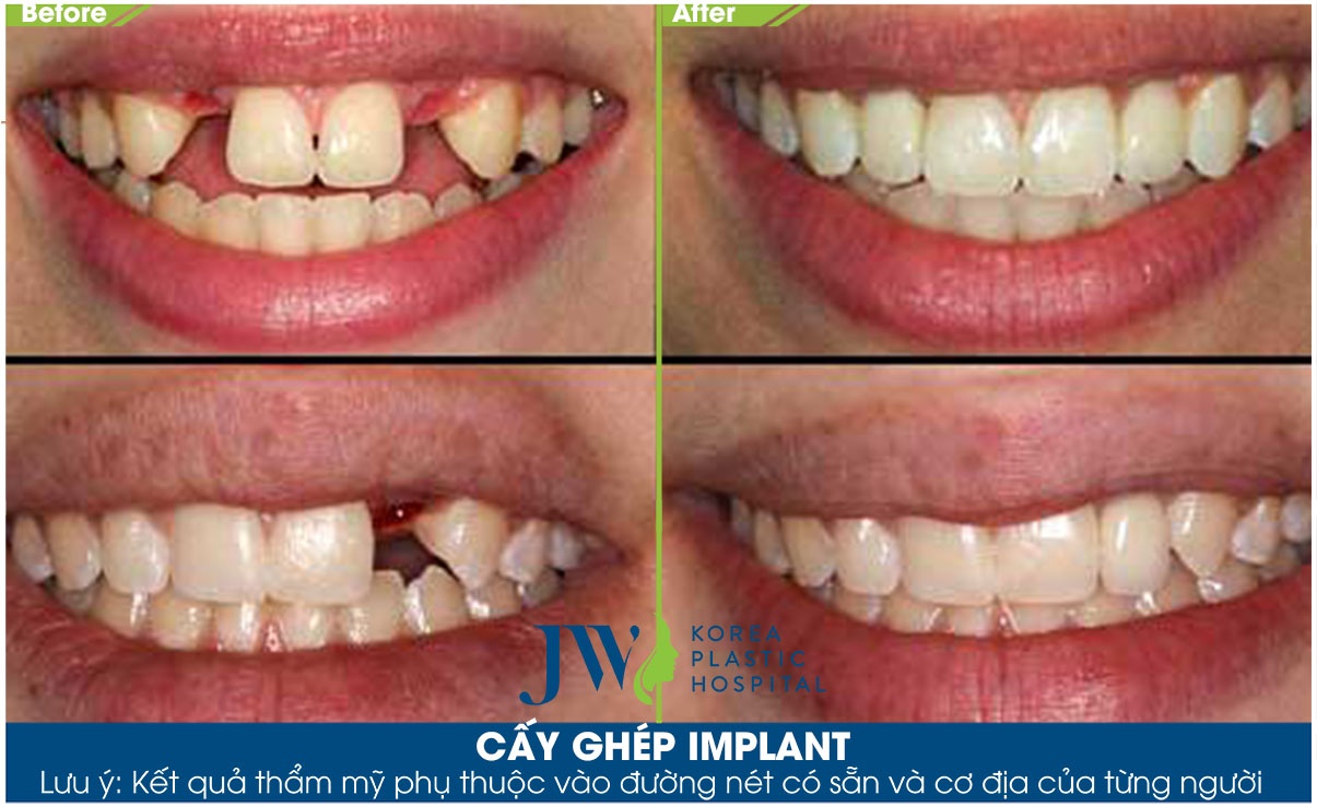 Benh vien tham my JW Han Quoc,  nha khoa,  trong ran anh 5