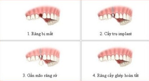 Nha Khoa Đông Nam ảnh 2 Nha Khoa Dong Nam anh 2