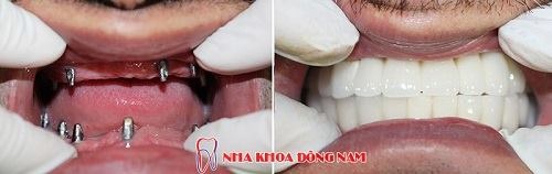 Nha Khoa Đông Nam ảnh 3 Nha Khoa Dong Nam anh 3