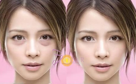 Nang mi, xoa quang tham, bong mat chi trong 60 phut hinh anh