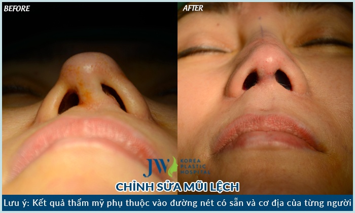 Benh vien tham my JW Han Quoc anh 2