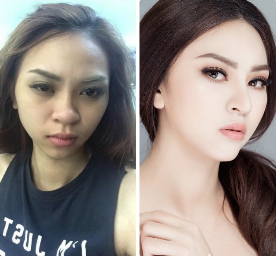 Bệnh viện Thẩm mỹ Kangnam  ảnh 2 Benh vien Tham my Kangnam anh 2