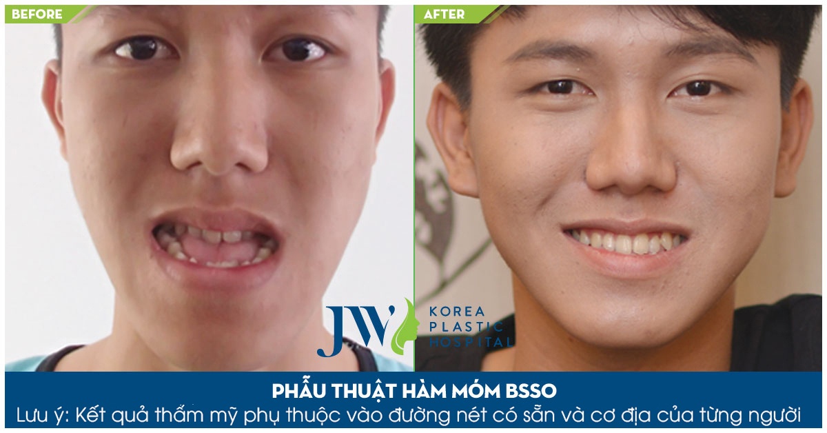 bệnh viện JW ảnh 2 benh vien JW anh 2