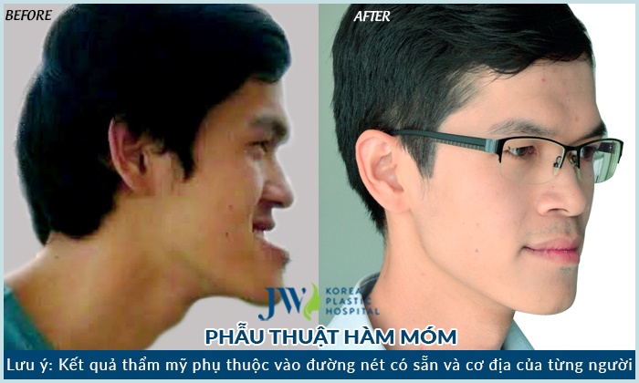 bệnh viện JW ảnh 3 benh vien JW anh 3