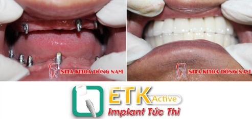 Nha khoa Dong Nam anh 3